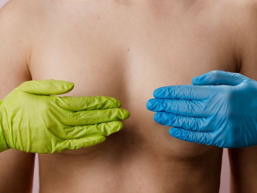 Breast Cancer Gave Me the Boobs I’ve Always Wanted